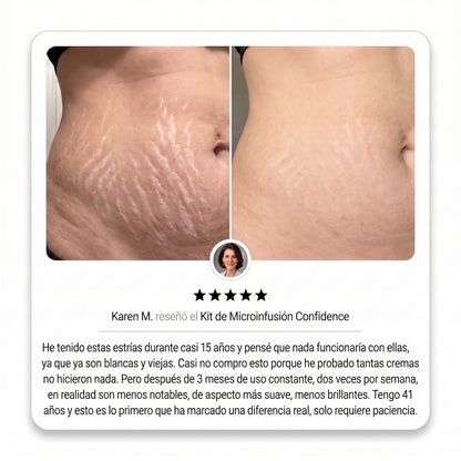 Sistema de Microinfusión PDRN
